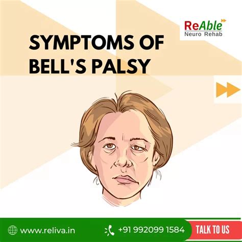 Ppt Bells Palsy Visual Series Powerpoint Presentation Free Download Id10809508