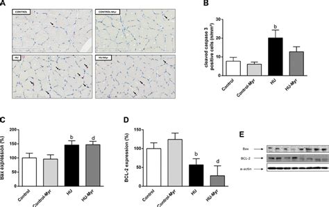 Effects Of Hindlimb Unloading And Myriocin Treatment On Skeletal Muscle