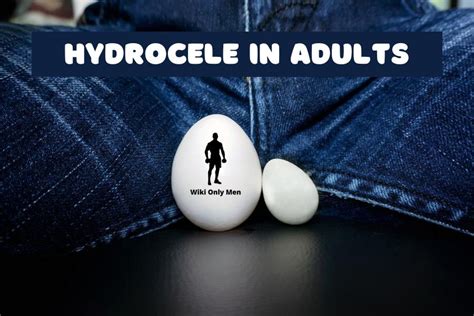 Hydrocele In Adults Symptoms Causes And Remedies Wiki Only Men