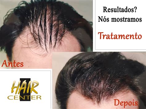 Hair Center | Porto