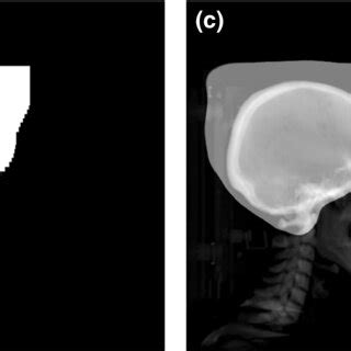 DRR images and MLC masks: (a) DRR‐reconstructed CT images, (b) mask ...