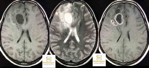 Radiology Spotters Set Radiogyan Radiogyan