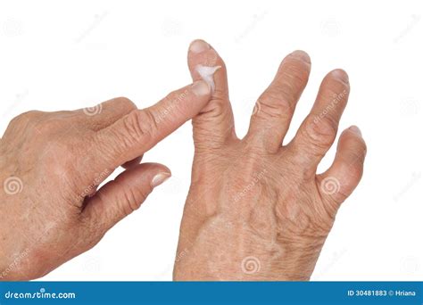 Rheumatoid Arthritis Of The Fingers. Using Medical Cream Stock Photos ...