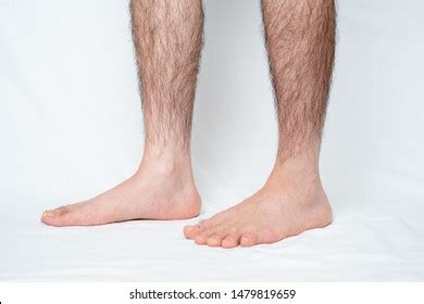 Legs Hair Removal Men Before Stock Photo 1479819743 | Shutterstock