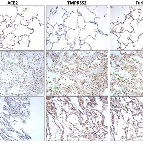 Ace Tmprss And Furin Expression In Alveolar Type Ii Pneumocytes And