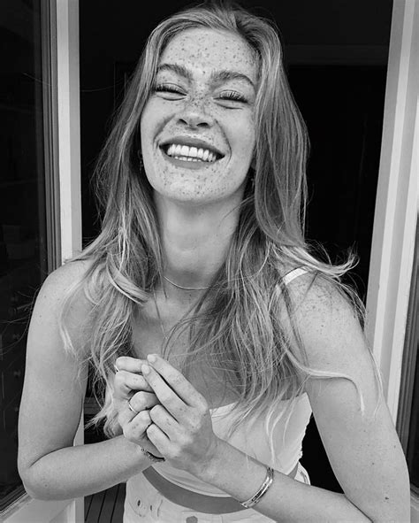 A Woman With Freckles On Her Face And Hands In Front Of A Window