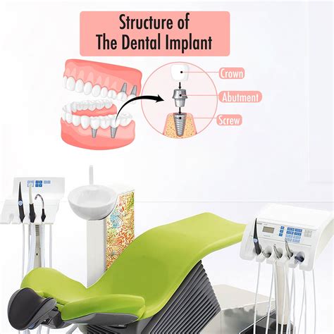 Dental Implant Wall Decor Smile Dental Stickers Dental Clinic Etsy