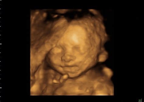24 Weeks Pregnant And Baby Development E Obstetricsandgynecology