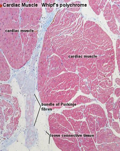 an image of the inside of someone's stomach showing what it looks like ...
