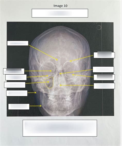 Pa Caldwell Image Diagram Quizlet