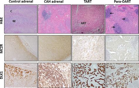 Frontiers Morphologic And Molecular Characterization Of Adrenals And