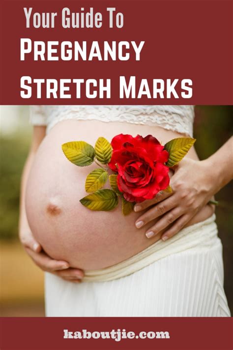 Your Guide To Pregnancy Stretch Marks