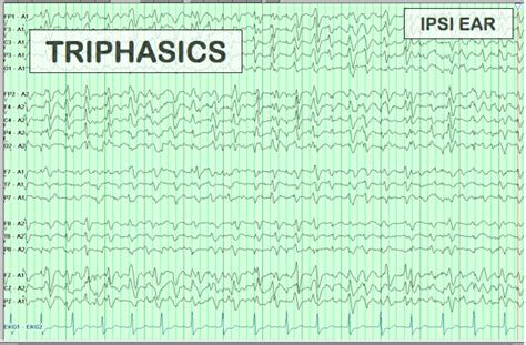 Triphasics