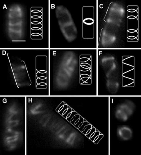 Various Configurations Of The Mreb Cytoskeleton In Mid Download