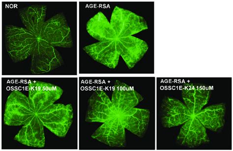 Fluorescein Isothiocyanate Dextran Angiography Displaying Retinal Flat