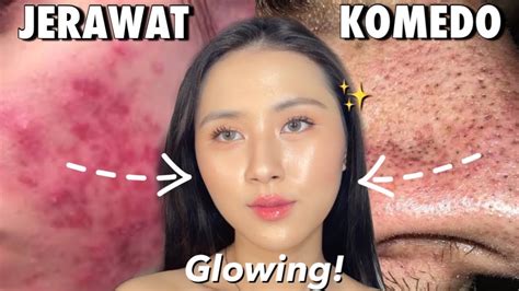 Bagaimana Aku Membangun Skincare Routine Yang Beneran Berfungsi Untuk Jerawat Komedo And Kulit