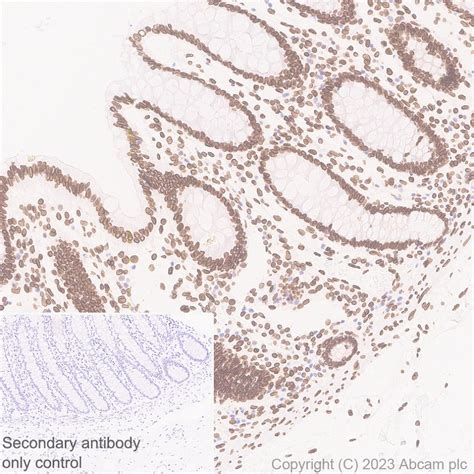 Recombinant Anti Lamin C Antibody EPR28295 16 KO Tested Ab314500