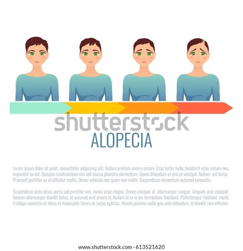 Alopecia Stages Set Front View Portrait Stock Vector (Royalty Free ...