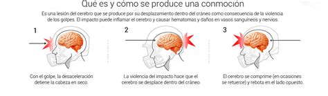 Signos De Conmociones Cerebrales Que Has De Saber Cuidandose