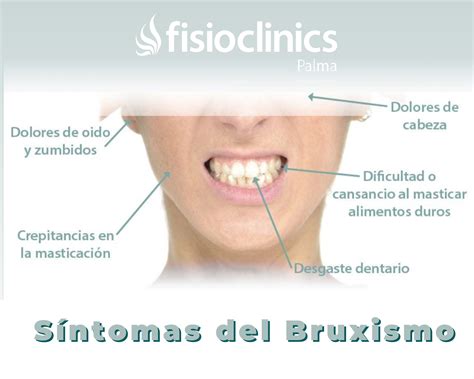 Cuál es la disfunción o trastorno de la articulación temporo mandibular