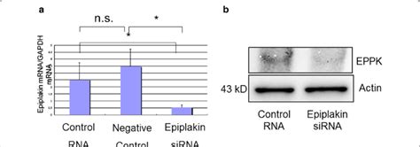 Epiplakin Knockdown In Cultured Corneal Epithelial Cell Line Epiplakin