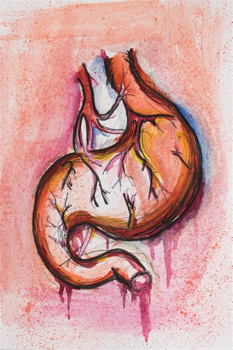 No: 189 – Stomach ulcer | Anatomy art, Line art drawings, Art reference