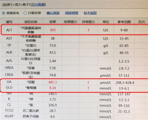 壹生资讯 Acs合并高脂血症年轻患者一例