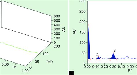 A To L A Hptlc Plate Before Spray At 366 Nm B Hptlc Plate After