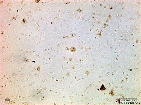 Entamoeba Nana Cyst