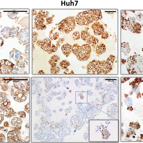 Liver Progenitor Lineage Markers Alpha Fetoprotein And Ck19 Download Scientific Diagram