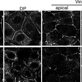 Myosin Vi Supports The Integrity Of Apical Junctional Complexes Myosin