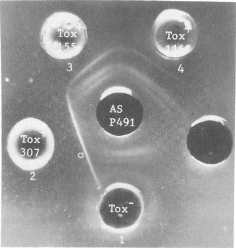 Reaction Of One Non Enterotoxic Tox And Three Porcine Enterotoxic