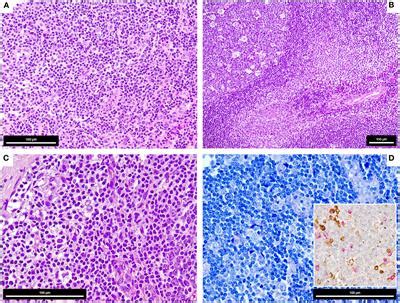 Frontiers Case Report Gene Expression Profiling Of Covid