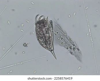 Freshwater Aquatic Zooplankton Algae Under Microscope Stock Photo ...