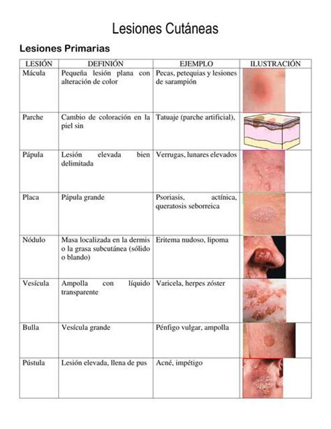 Lesiones Cutáneas Rashell Pavon Udocz