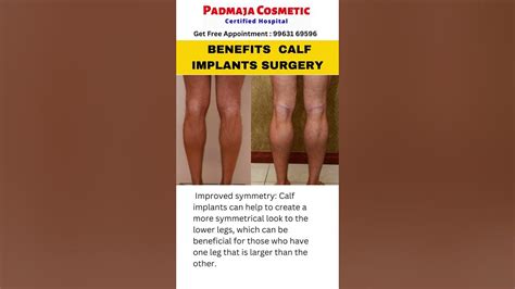 Benefits Calf Implants Surgery Shorts Healthtips Dailyupdates Hospital Treatment Viral