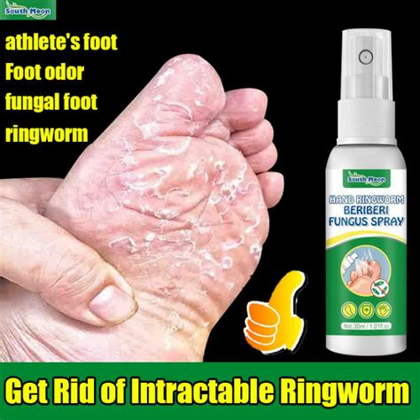 South Moon Anti Fungal Athlete Foot Spray 30ml Relieve Beriberi Toe