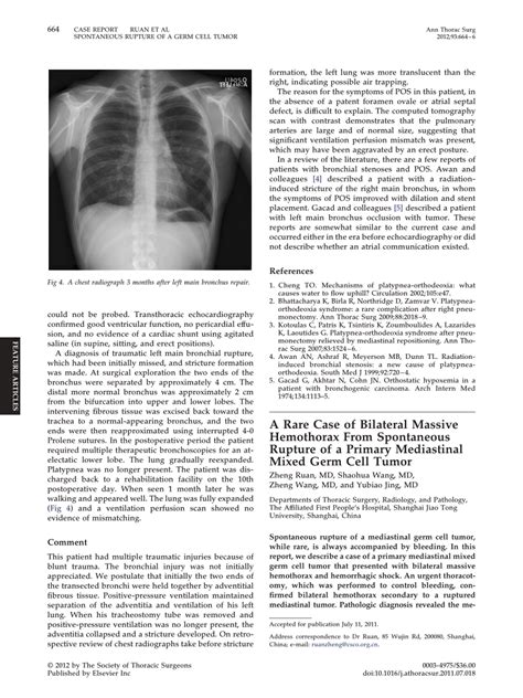 Pdf A Rare Case Of Bilateral Massive Hemothorax From Spontaneous