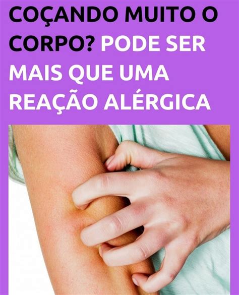 O Que Pode Ser Quando Sinto Coceira No Corpo Fatos Da Vida