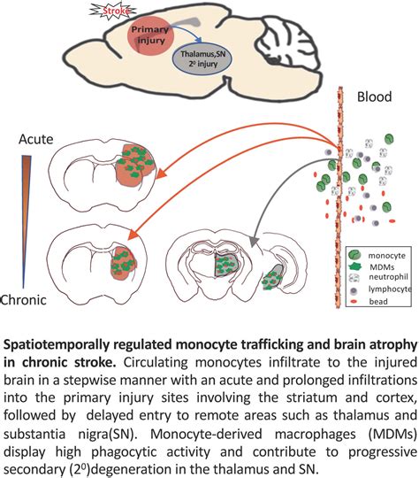 Stroke AHA ASA On Twitter Delayed Infiltration Of Peripheral Monocyte