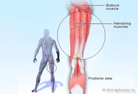 Hamstring injuries: Cause, symptoms & recovery - Carl Todd Clinic