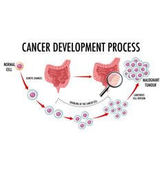 Diagram Showing Cancer Development Process Vector Image