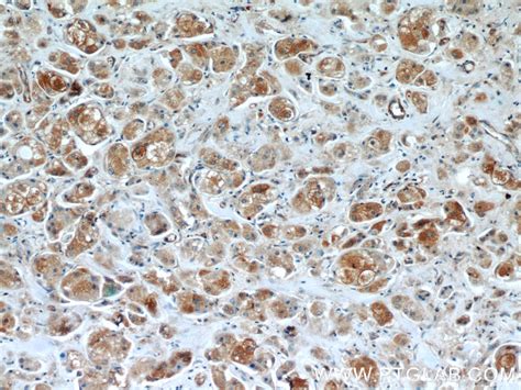 BRCA1 Antibody (22362-1-AP) | Proteintech