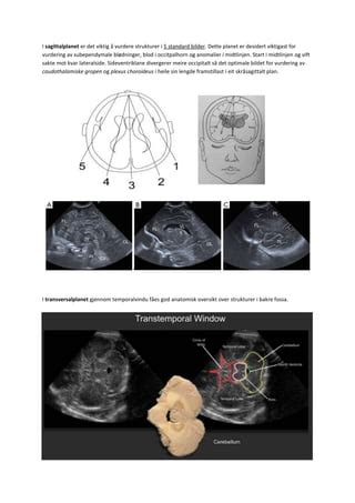 Cerebral Ultralyd Pdf