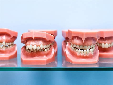 Cómo saber si necesito ortodoncia Ustrell García Clínica Dental