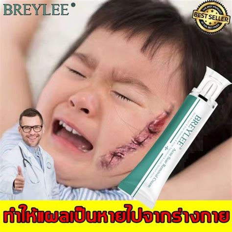 ครีมแผลเป็น Breylee รอยแผล รอยแผลถาวร ครีมทาแผลผ่าคลอด ทาแผลคีลอยด์ รีมทาแผลเป็น ลดแผลไฟไหม้ แผล