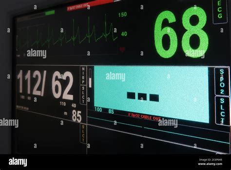 Electrocardiogram Ecg Hi Res Stock Photography And Images Alamy