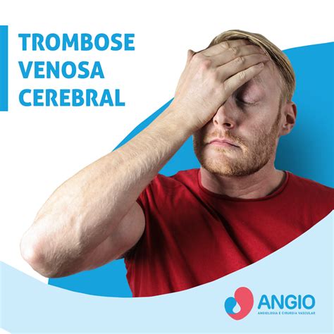 Saiba Mais Sobre A Trombose Venosa Cerebral Angio Angiologia E