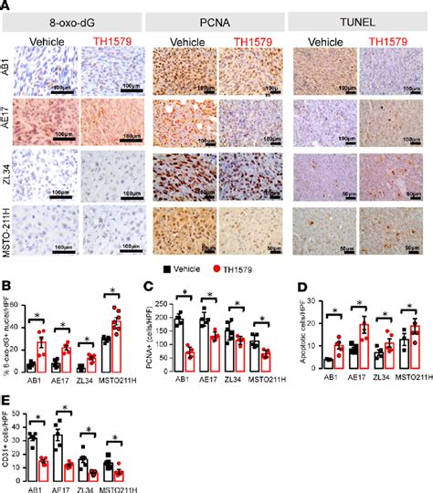 Mth Inhibition Elevates Tumor Cell Oxo Dg Levels In Mesothelioma