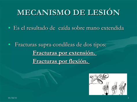 Fractura Supracond Lea Intercond Lea Humeral Ppt